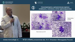 Примеры использования цитологического исследования для диагностики рака легкого