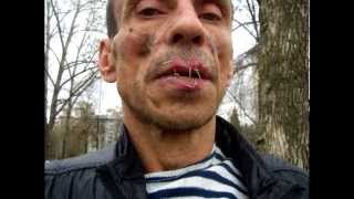 Зека зашил себе рот. Не для слабонервных.