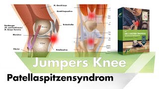 Knieschmerzen Vorne | Ursachen & Lösung (Knieschmerzen sind keine Arthrose)