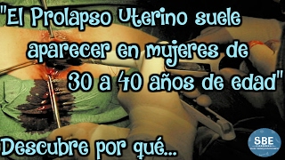 ¿Qué es el prolapso uterino?  ¿Cuáles son sus síntomas y sus causas?
