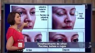 Mulheres - Saúde: Cirurgias para rejuvenescimento dos olhos (06/11/2015)