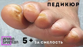 НЕ ДЛЯ СЛАБОНЕРВНЫХ педикюр!!! ? Возрастные ножки тоже хотят красоты