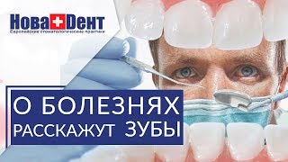 ? О каких заболеваниях можно судить по языку и запаху изо рта. Диагностика заболеваний по языку. 12+