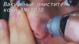 Вакуумный очиститель кожи XN 8030