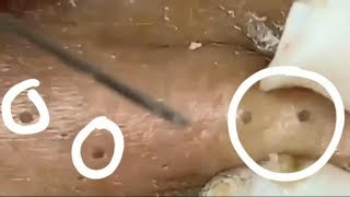 Tratamento Facial Brilhante para o Clientes #1 | Facial Treatment for Glowing Skin