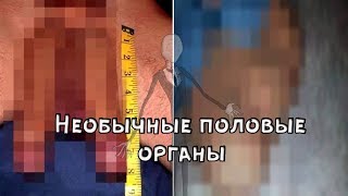 10 ЛЮДЕЙ С НЕОБЫЧНЫМИ ПОЛОВЫМИ ОРГАНАМИ