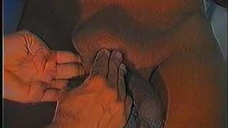 Examination of inguino-scrotal swelling