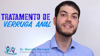 Tratamento de verrugas anais | Dr. Marcelo Werneck