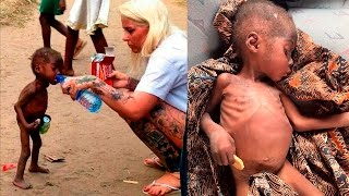УДИВИТЕЛЬНОЕ СПАСЕНИЕ ДВУХЛЕТНЕГО МАЛЬЧИКА ИЗ НИГЕРИИ