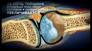 «Живая Клетка VI» - надежная защита суставов