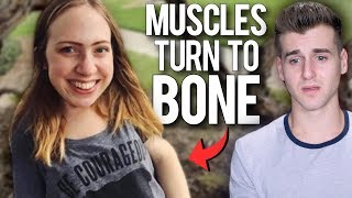 Meet The Girl Whose Muscles Are Turning Into Bone