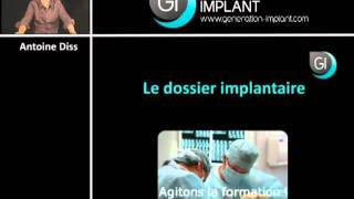 Implant dentaire : Le dossier implantaire