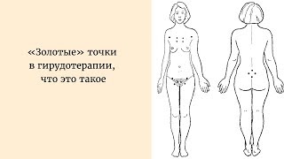 Гирудотерапия в гинекологии. Точки постановки пиявок