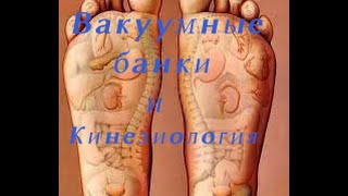 Вакуумные банки и кинезиология
