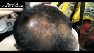 Объем для тонких редких волос