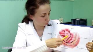 Гигиенические преимущества менструальной чаши. Рассказывает гинеколог