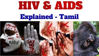 History Of HIV and AIDS Virus | Symptoms | Control Methods - Explained Tamil.