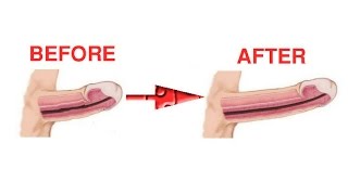 Enlarge Your Penis With Hands Just in 2 Weeks