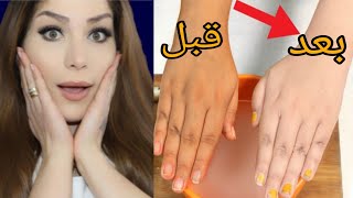 تبييض اليدين في 5 دقائق من اول استعمال