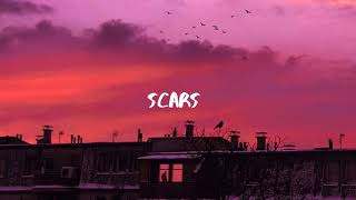 "Alive" - Ali Gatie x Lewis Capaldi x Jeremy Zucker Type Beat