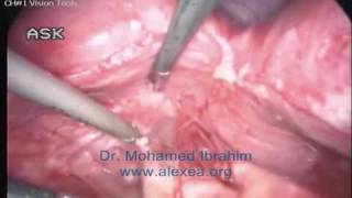 14 years old patient case presentation