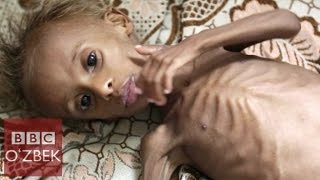 'Ҳа, миллионлаб одам ўлиши мумкин' - BBC O'zbek