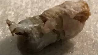 517 - The Most Relieving Ear Wax Removal Ever Causing Client to Faint
