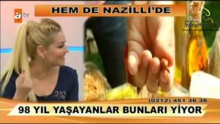 Zahide ile Yetiş Hayata 08.05.2014 1.Kısım / İbrahim Saraçoğlu'dan Göz Altı Kırışıkları İçin Krem