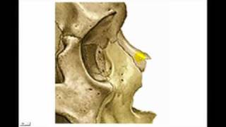 CARA 1 - MAXILAR SUPERIOR Diagnostico X