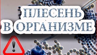 Плесень в организме и действие соды  - Огулов А Т