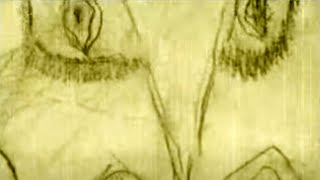 DVAR - Hissen Raii