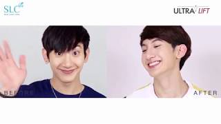 Ultralift หน้าเรียว หน้ากระชับ หันกล้องมุมไหนก็มั่นใจ คุณ ท๊อปแทป จิรกิตต์ หน้าเป๊ะ