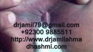 Piles Bleeding Hemorrhoids Treatment |Cure of Piles Fistula hemorrhoids Hydrocele | piles Clinic