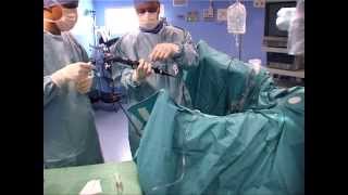 Utilisation et maintenance des fibres laser lors d'une urétéro-rénoscopie flexible