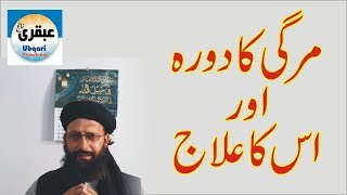 Mirgi ka dora | مرگی کا دورہ | ubqari knowledge