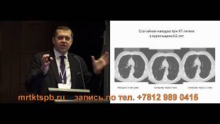 Диагностика рака легкого на КТ