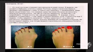 valgus plus производитель

  - Вальгус про недорого купить.