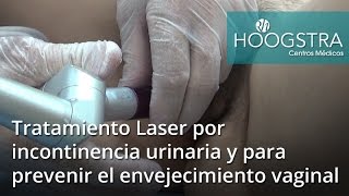 Tratamiento Laser por incontinencia urinaria y para prevenir el envejecimiento vaginal (17034)