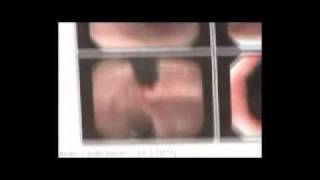 TESTIMONIO BESP CON GANO CAFE PARTE 1 2 flv